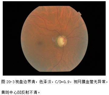 ZY016_102_4.gif